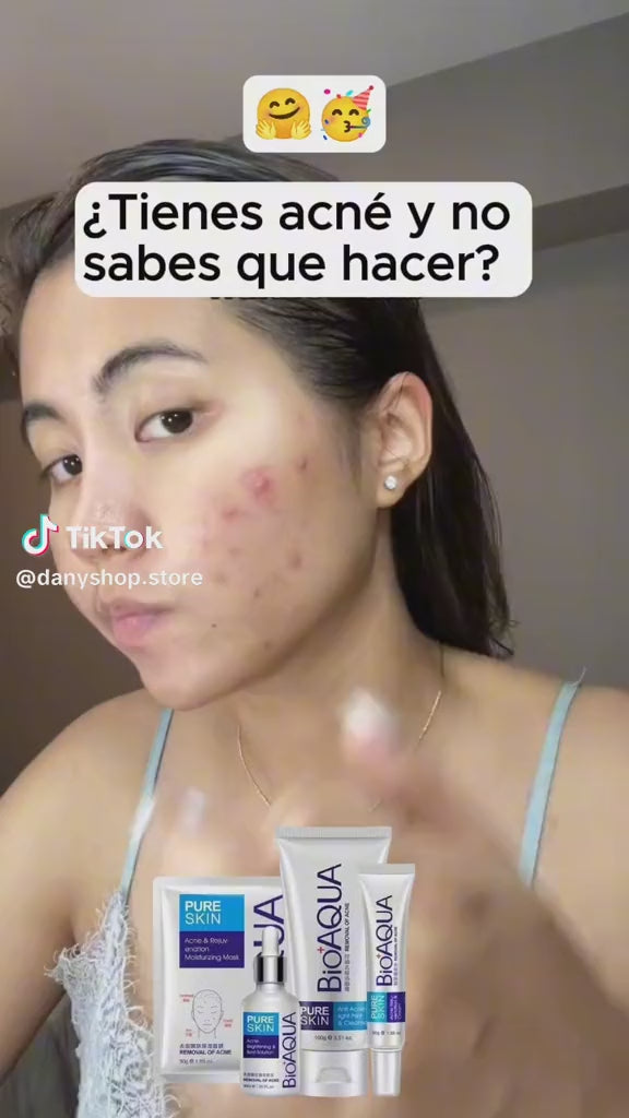 KIT FACIAL ANTIACNE BIOAQUA